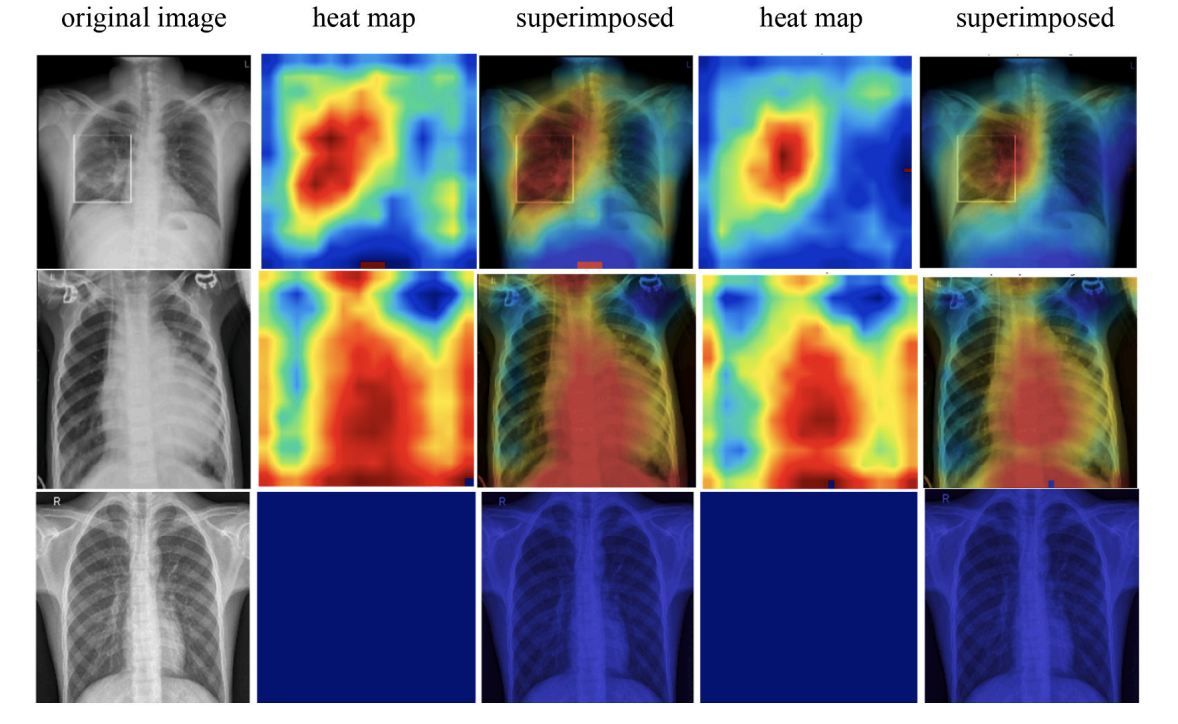 Grad-CAM visualization (Fig. 12)