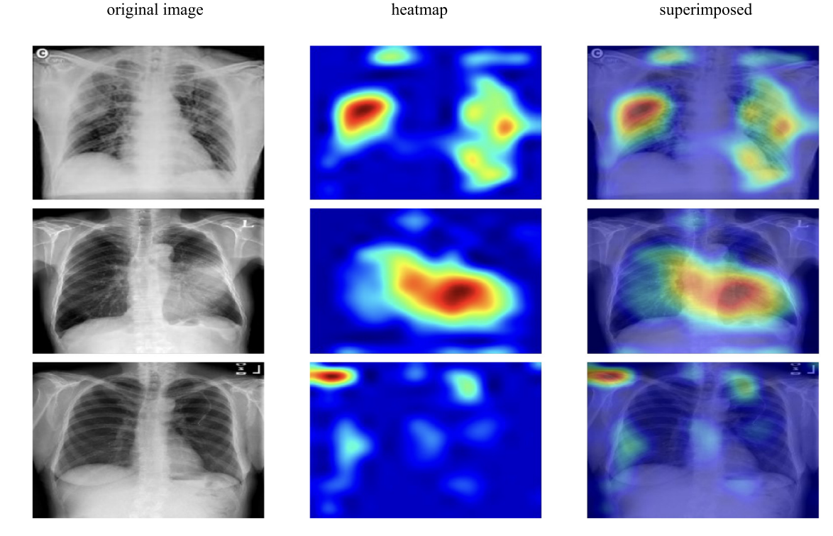 Grad-CAM visualization (Fig. 9)